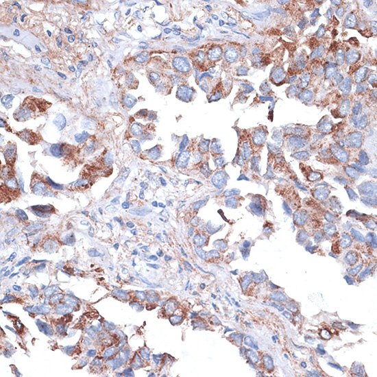 TIM-3/HAVCR2 Rabbit Polyclonal Antibody - Image 2