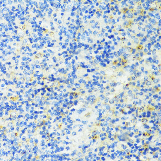 TIM-3/HAVCR2 Rabbit Polyclonal Antibody - Image 3