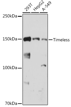 Timeless Rabbit Monoclonal Antibody