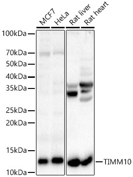 TIMM10 Rabbit Polyclonal Antibody