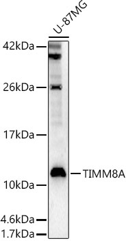 TIMM8A Rabbit Polyclonal Antibody