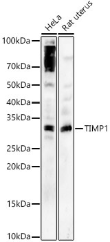 TIMP1 Rabbit Polyclonal Antibody