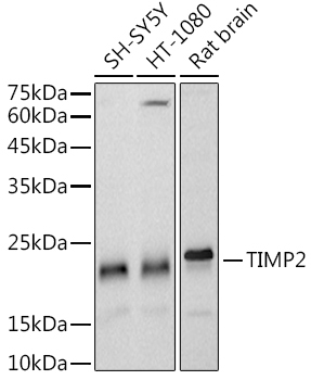 TIMP2 Rabbit Monoclonal Antibody