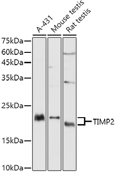 TIMP2 Rabbit Polyclonal Antibody