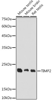 TIMP2 Rabbit Polyclonal Antibody
