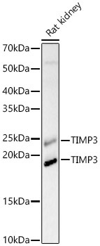 TIMP3 Rabbit Polyclonal Antibody