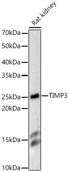 TIMP3 Rabbit Polyclonal Antibody