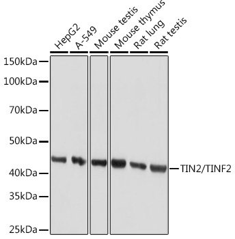 TIN2/TINF2 Rabbit Monoclonal Antibody