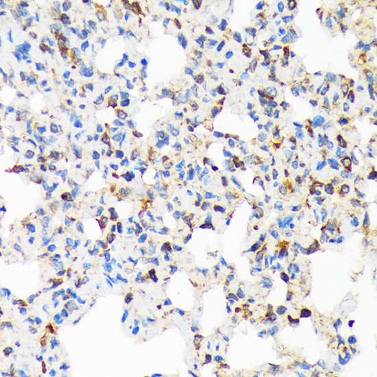 TIRAP Rabbit Monoclonal Antibody - Image 2