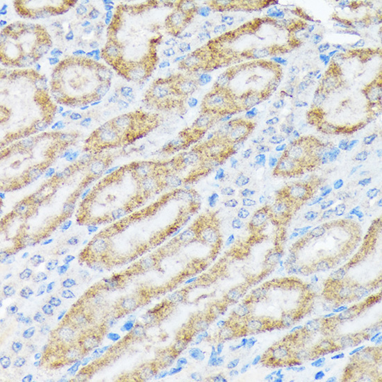 TIRAP Rabbit Monoclonal Antibody - Image 3