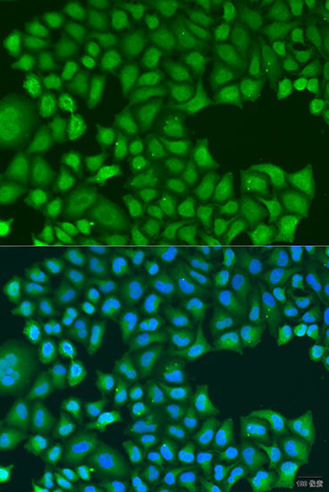 TIRAP Rabbit Polyclonal Antibody - Image 2