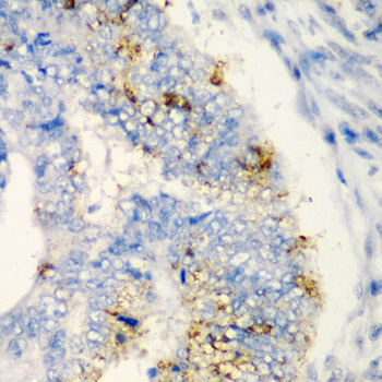 TIRAP Rabbit Polyclonal Antibody - Image 2