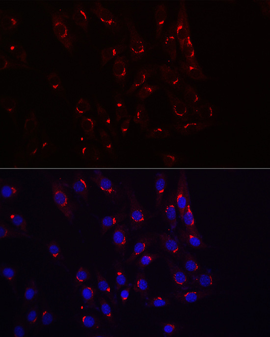 TJAP1 Rabbit Polyclonal Antibody
