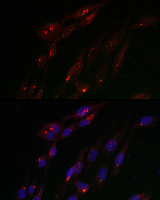 TJAP1 Rabbit Polyclonal Antibody - Image 2