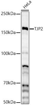 TJP2 Rabbit Polyclonal Antibody