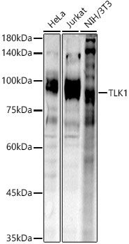 TLK1 Rabbit Polyclonal Antibody