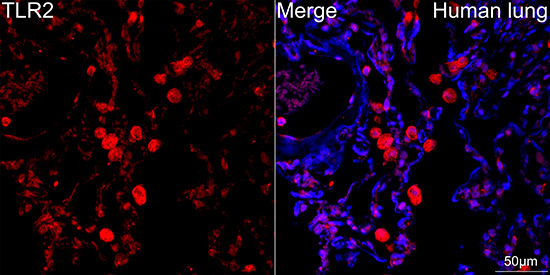 TLR2 Rabbit Monoclonal Antibody - Image 2