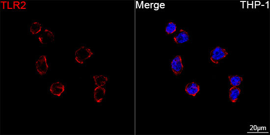 TLR2 Rabbit Monoclonal Antibody - Image 3