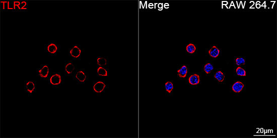TLR2 Rabbit Monoclonal Antibody - Image 4