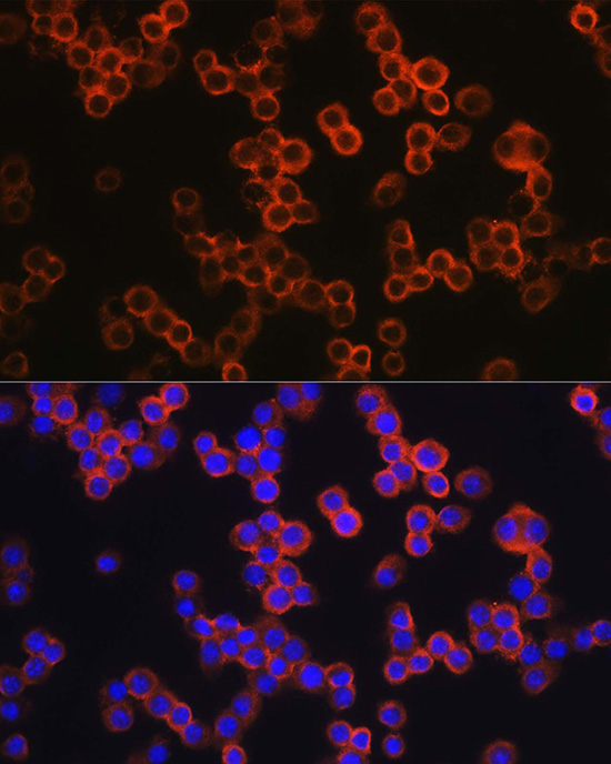 TLR4 Rabbit Polyclonal Antibody - Image 3