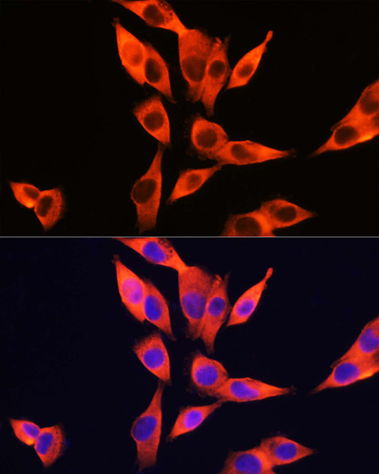 TLR4 Rabbit Polyclonal Antibody - Image 4