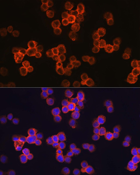 TLR4 Rabbit Polyclonal Antibody - Image 5