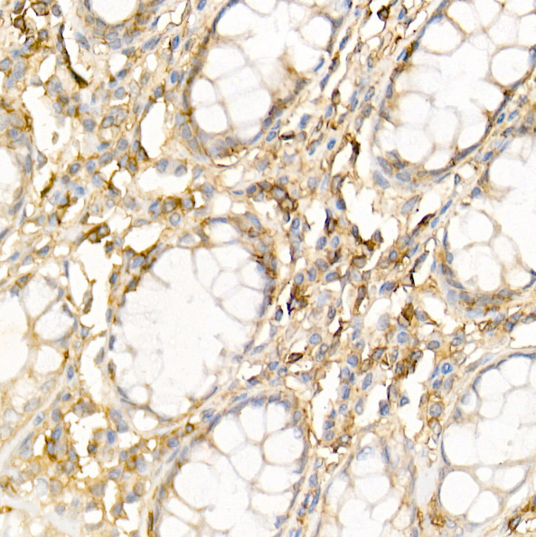 TLR5 Rabbit Polyclonal Antibody - Image 2