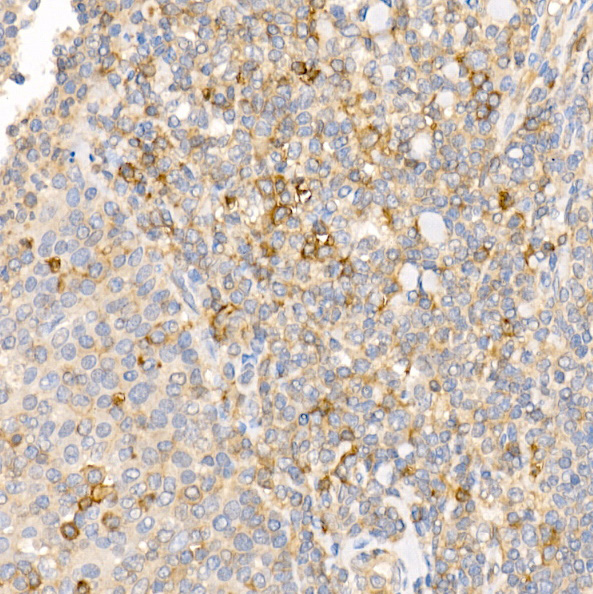 TLR5 Rabbit Polyclonal Antibody - Image 3