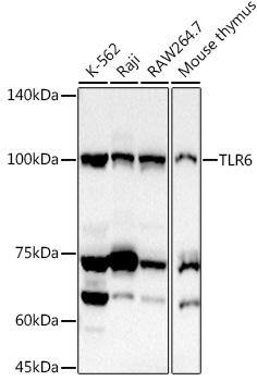TLR6 Rabbit Polyclonal Antibody
