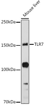 TLR7 Rabbit Polyclonal Antibody