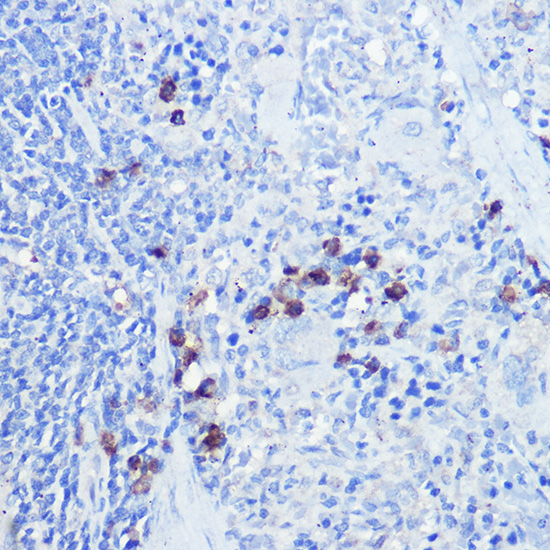 TLR9 Rabbit Polyclonal Antibody - Image 2