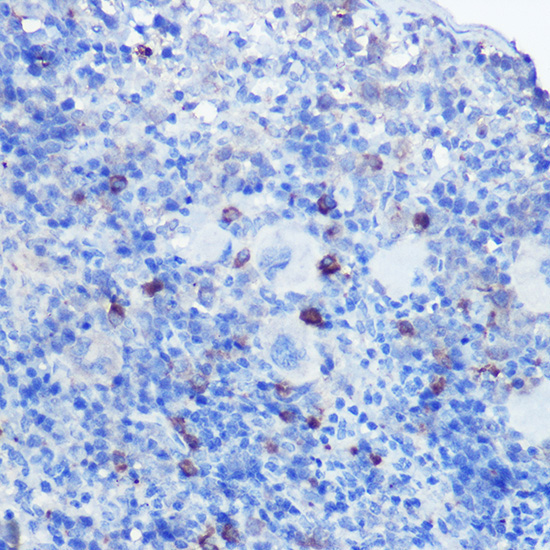 TLR9 Rabbit Polyclonal Antibody - Image 4