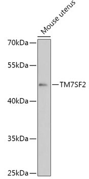 TM7SF2 Rabbit Polyclonal Antibody