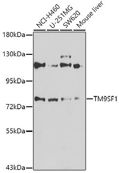 TM9SF1 Rabbit Polyclonal Antibody