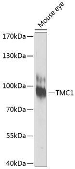 TMC1 Rabbit Polyclonal Antibody
