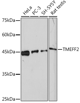 TMEFF2 Rabbit Monoclonal Antibody