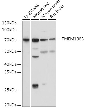 TMEM106B Rabbit Polyclonal Antibody