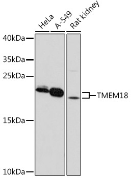 TMEM18 Rabbit Polyclonal Antibody