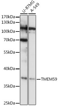 TMEM59 Rabbit Polyclonal Antibody