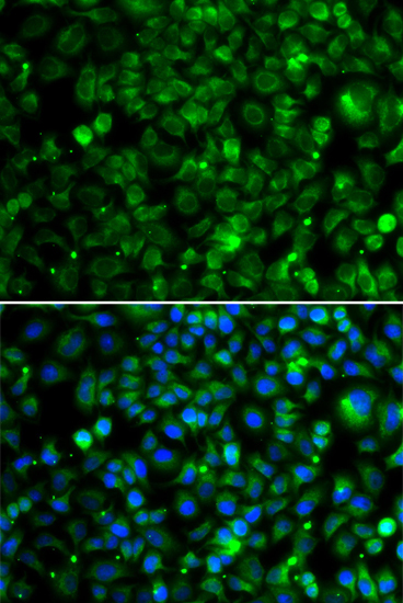 TMLHE Rabbit Polyclonal Antibody