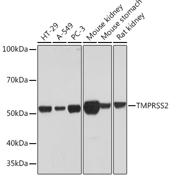 TMPRSS2 Rabbit Monoclonal Antibody