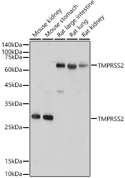 TMPRSS2 Rabbit Polyclonal Antibody