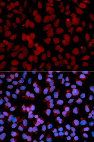 TNFAIP3 Rabbit Polyclonal Antibody
