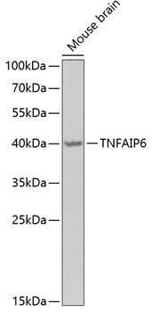 TNFAIP6 Rabbit Polyclonal Antibody