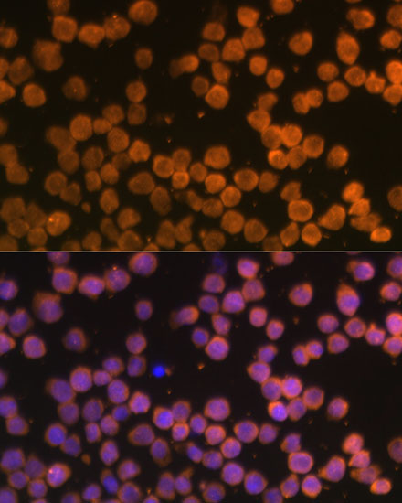 TNFRSF10A Rabbit Polyclonal Antibody - Image 2