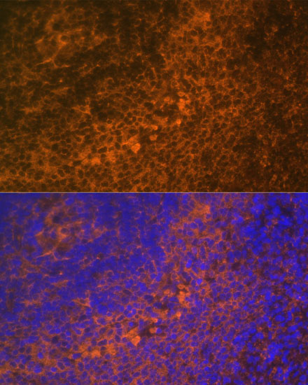 TNFRSF10A Rabbit Polyclonal Antibody - Image 3