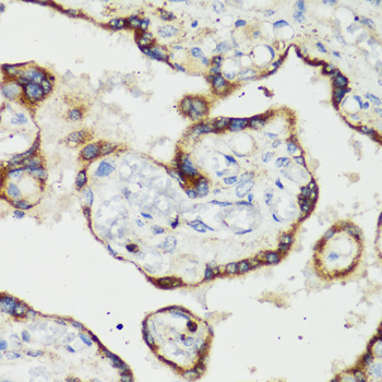 TNFSF11 Rabbit Polyclonal Antibody - Image 2