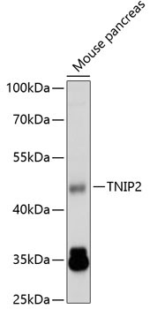 TNIP2 Rabbit Polyclonal Antibody