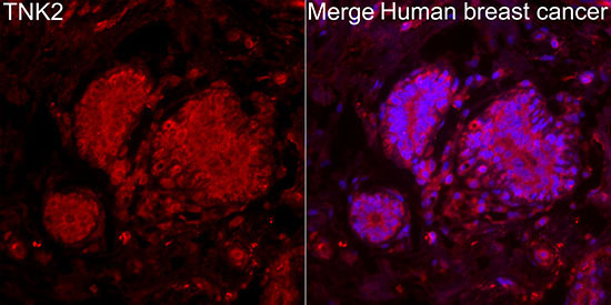 TNK2 Rabbit Polyclonal Antibody
