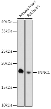TNNC1 Rabbit Monoclonal Antibody